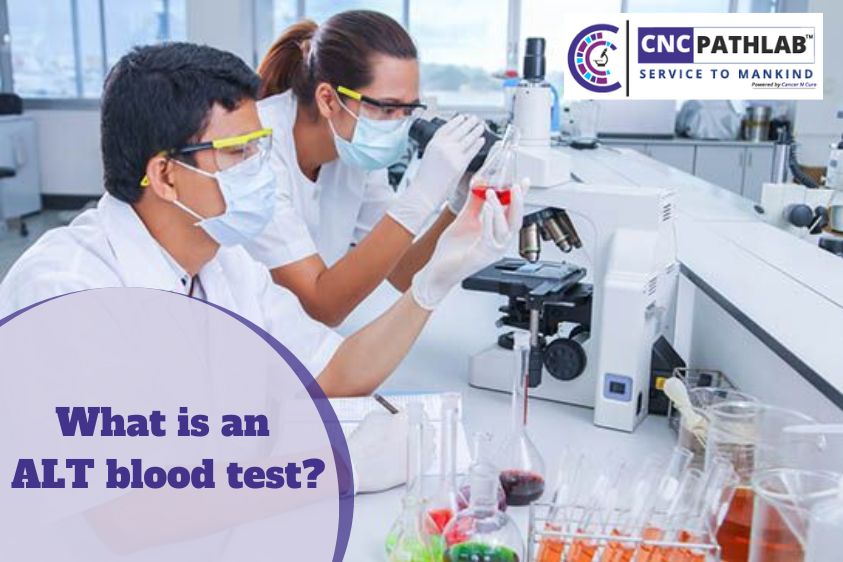 What is an ALT blood test?